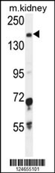 IGSF1 Antibody (C-term)