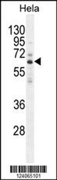 HYAL2 Antibody (C-term)