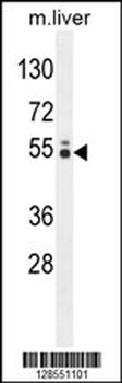 GLCCI1 Antibody (N-term)