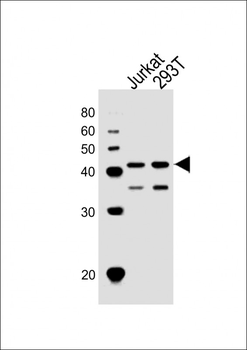 ETS1 Antibody (N-term)