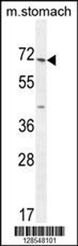 ESCO2 Antibody (Center)