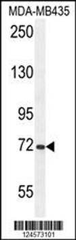 ARHGAP10 Antibody (Center)