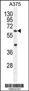 ACF Antibody (C-term)
