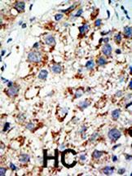 SAE2 (UBA2) Antibody (C-term E616)