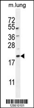 APG8a/b(MAP1LC3A/B) Antibody