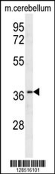 OR10X1 Antibody (Center)
