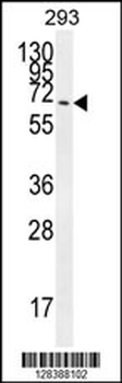 CCDC37 Antibody (N-term)