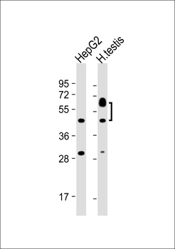 SPATC1 Antibody (N-term)