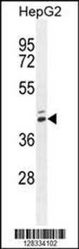 MAMSTR Antibody (N-term)