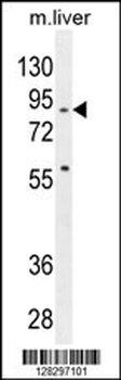 SPIRE2 Antibody (Center)
