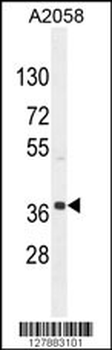 NKAPL Antibody (C-term)