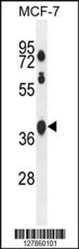SPATA2L Antibody (Center)