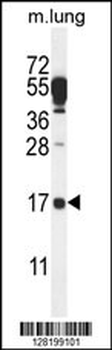 DTD2 Antibody (C-term)