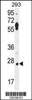 LRRC57 Antibody (C-term)