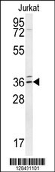 TPGS2 Antibody (Center)
