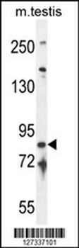 IFT81 Antibody (C-term)