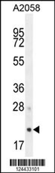 AP3S1 Antibody (N-term)