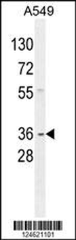 GNAT3 Antibody (Center)