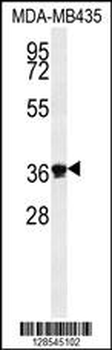 DEM1 Antibody (Center)