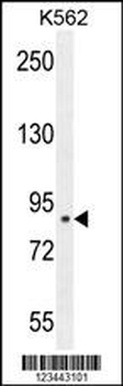 CLIC6 Antibody (Center)
