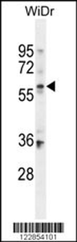 BCMO1 Antibody (Center)