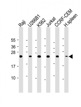 CTLA4 Antibody (N-term)