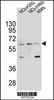 LILRA2 Antibody (Center)