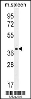 LHFPL5 Antibody (C-term)