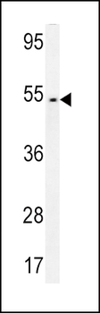 FAM46A Antibody (Center)