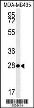 MRM1 Antibody (N-term)