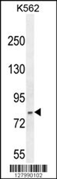 HHIPL2 Antibody (Center)