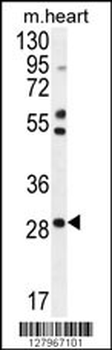 RNF183 Antibody (Center)
