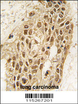 Dnmt3a Antibody (N-term R46)