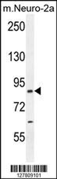 CCDC123 Antibody (C-term)
