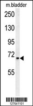 SLC25A12 Antibody (N-Term)