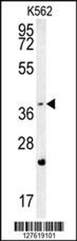 FBXW12 Antibody (C-term)