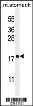 DYNLRB2 Antibody (Center)