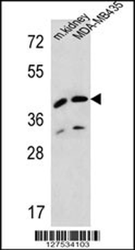 L2HGDH Antibody (Center)
