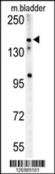 CASZ1 Antibody (C-term)