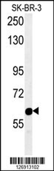 RADIL Antibody (C-term)