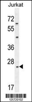 CLDN22 Antibody (Center)