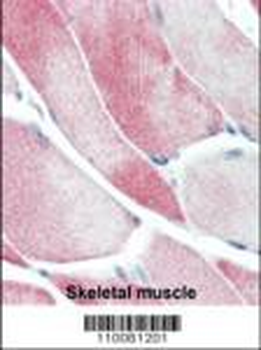 M JMJD3 Antibody (C-term)