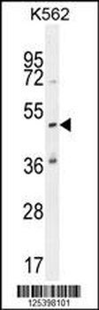 KATL1 Antibody (N-term)