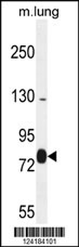 EXOC8 Antibody (Center)