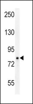 OCA2 Antibody (N-Term)