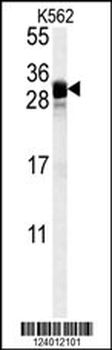 FGF7 Antibody (Center)