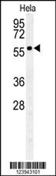 GALNT4 Antibody (N-term)