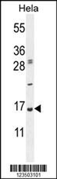 UBA52 Antibody (C-Term)
