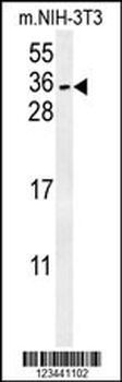 CITED2 Antibody (C-term)