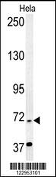 RAD26 Antibody (N-term)